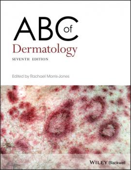 Читать ABC of Dermatology - Группа авторов