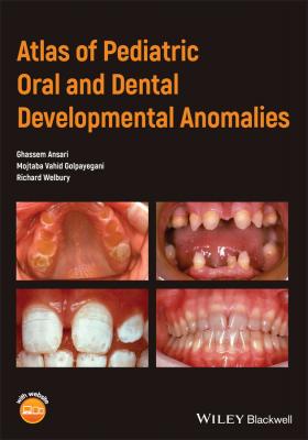 Atlas of Pediatric Oral and Dental Developmental Anomalies - Richard  Welbury