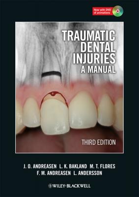 Traumatic Dental Injuries. A Manual - Lars  Andersson