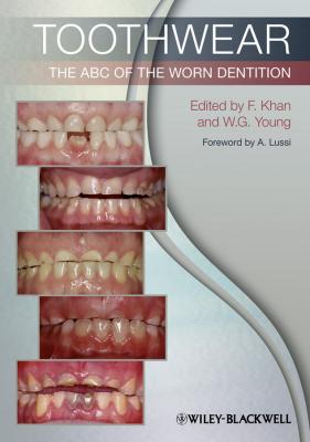 Toothwear. The ABC of the Worn Dentition - Farid  Khan