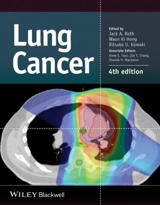 Lung Cancer - Jack Roth A.