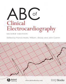 Читать ABC of Clinical Electrocardiography - Francis  Morris