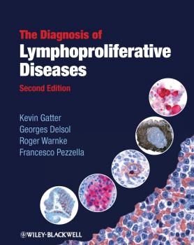 Читать The Diagnosis of Lymphoproliferative Diseases - Kevin  Gatter
