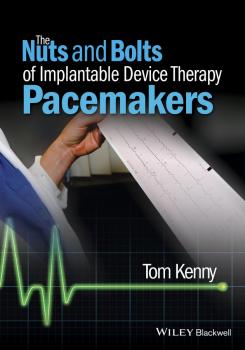 Читать The Nuts and Bolts of Implantable Device Therapy. Pacemakers - Tom  Kenny