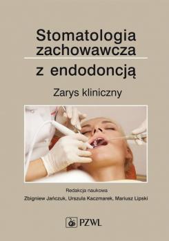 Читать Stomatologia zachowawcza z endodoncją - Отсутствует