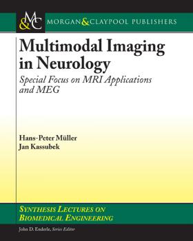 Читать Multimodal Imaging in Neurology - Hans-Peter Müller