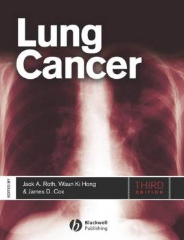 Читать Lung Cancer - Jack Roth A.