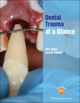 Читать Dental Trauma at a Glance - Aws Alani